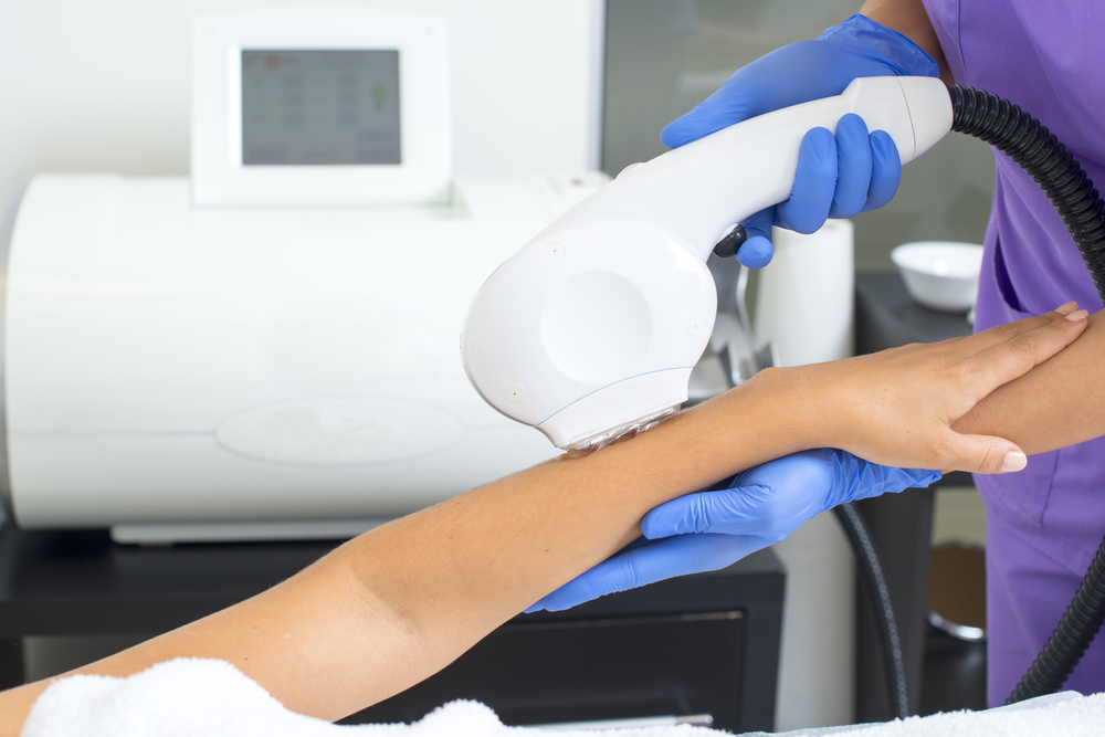 laser hair removal clinic in Memphis